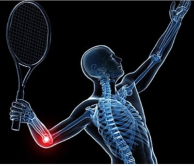 diagram of elbow pain